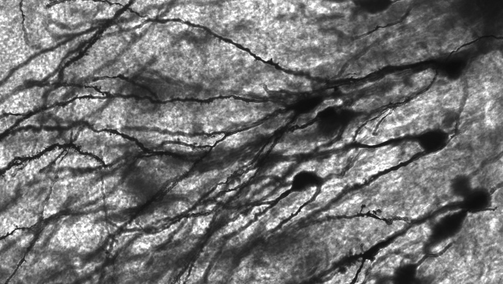 Detalle micrografía de neuronas del giro dentado